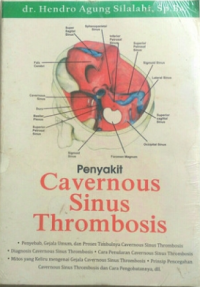 penyakit cavernous sinus thrombosis