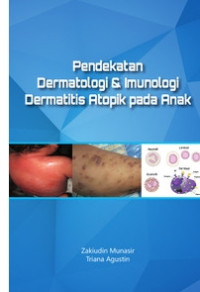Image of Pendekatan Dermatologi & Imunologi Dermatutis pada Anak